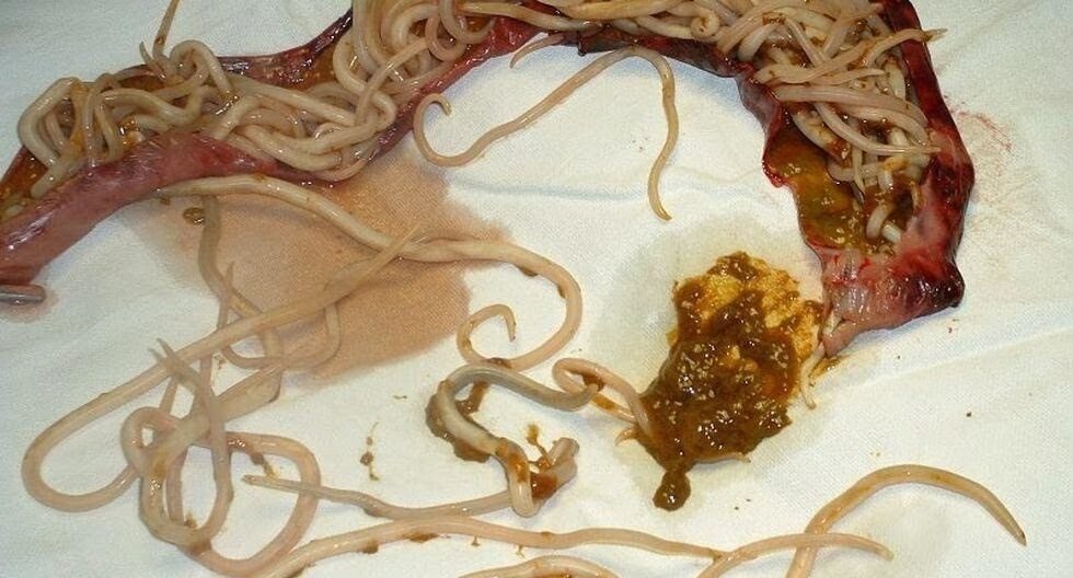 worm4